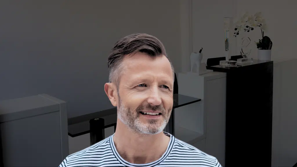Peri-implantitis treatment restoring a happy patients smile.