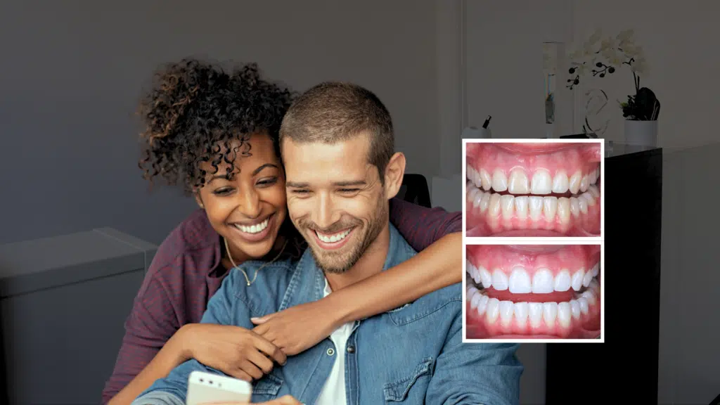 A smiling couple with rejuvenated and brightened smiles after teeth whitening treatment in London