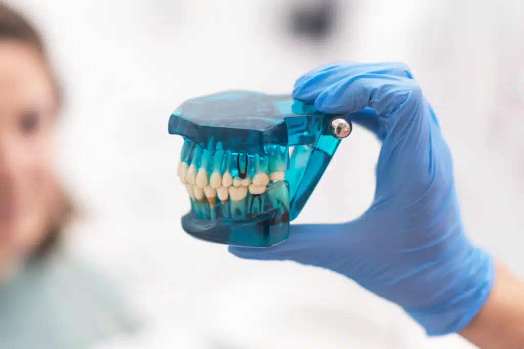 Dental Implants London Treatment
