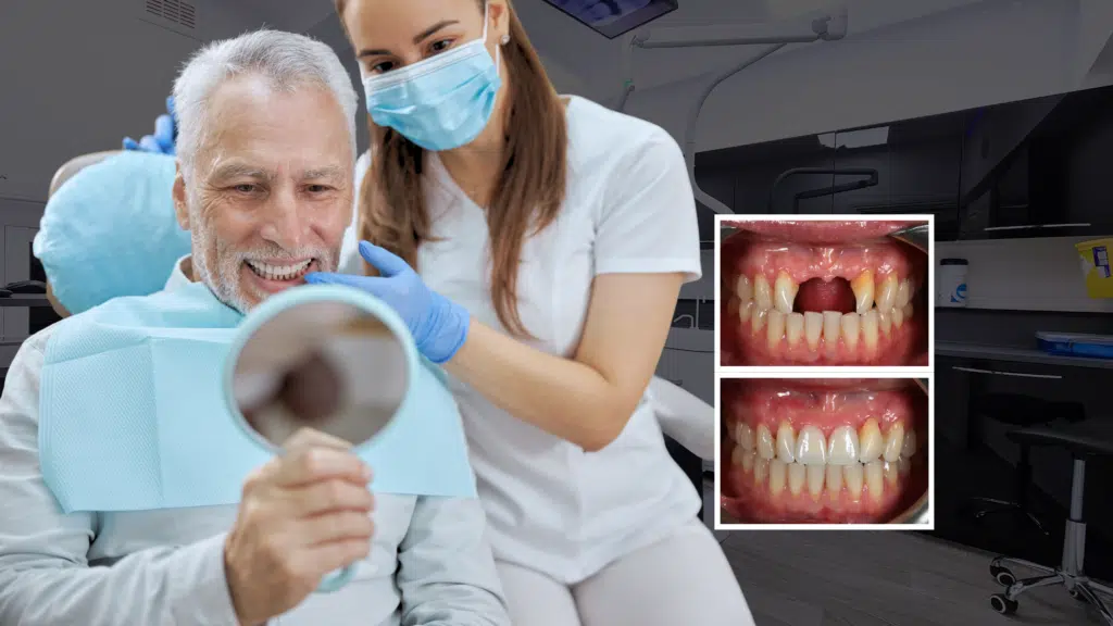 Dental Implants London