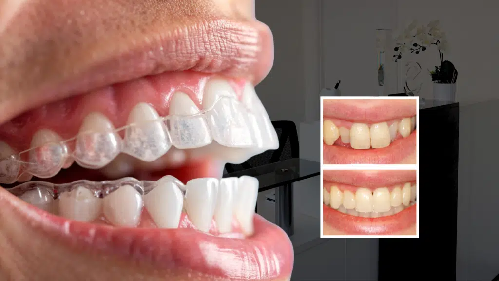 Orthodontist London
