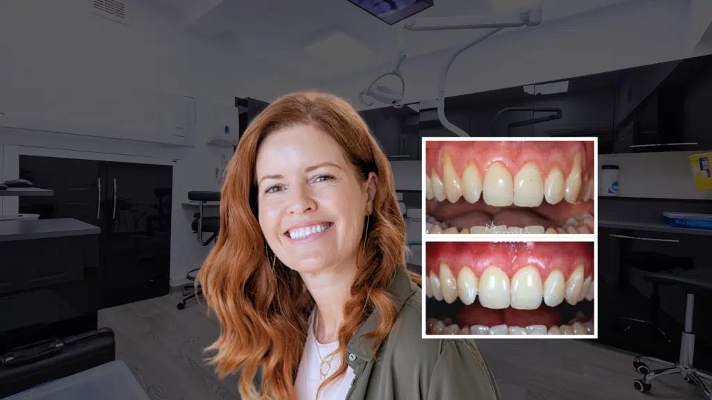 Our gum specialist has transformed thousands of smiles with a range of different specialist periodontist treatments