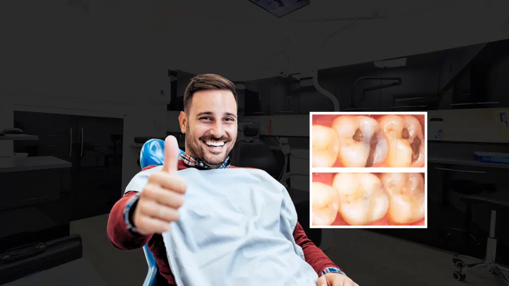 Smiling patient gives a thumbs-up during SMART mercury amalgam removal
