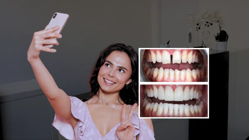 SmileFast Technology