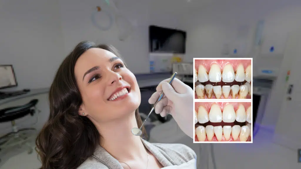 A woman pleased with results after sitting in a dental chair during a professional dental hygiene appointment in London
