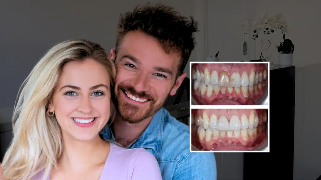 award-winning dentist providing dental veneers in london