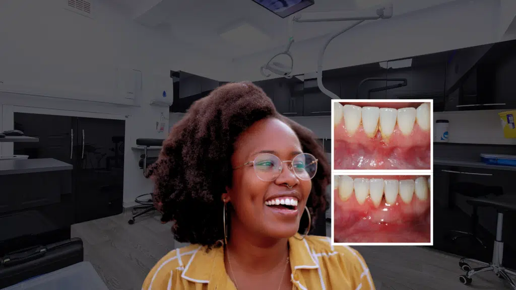 a happy patient who has restored her gums after gum disease treatment in london